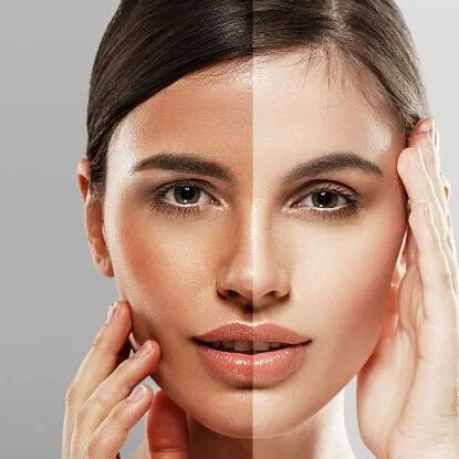 face whitening